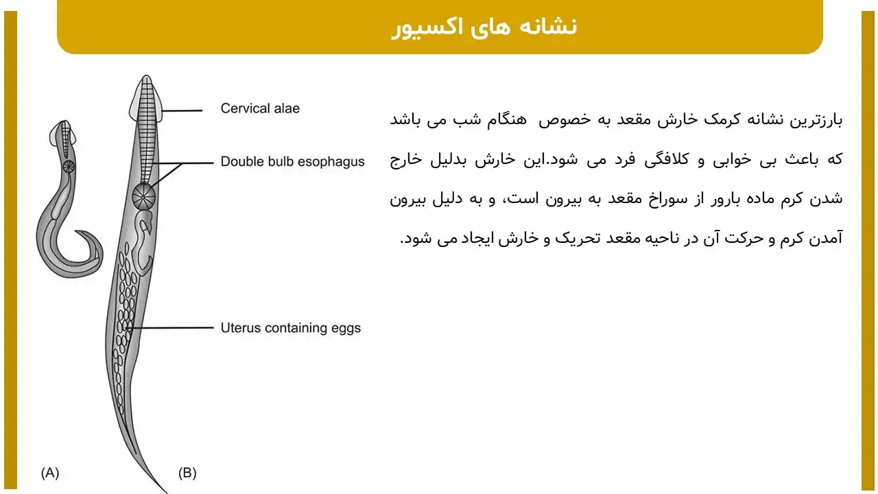 پاورپوینت انگل روده