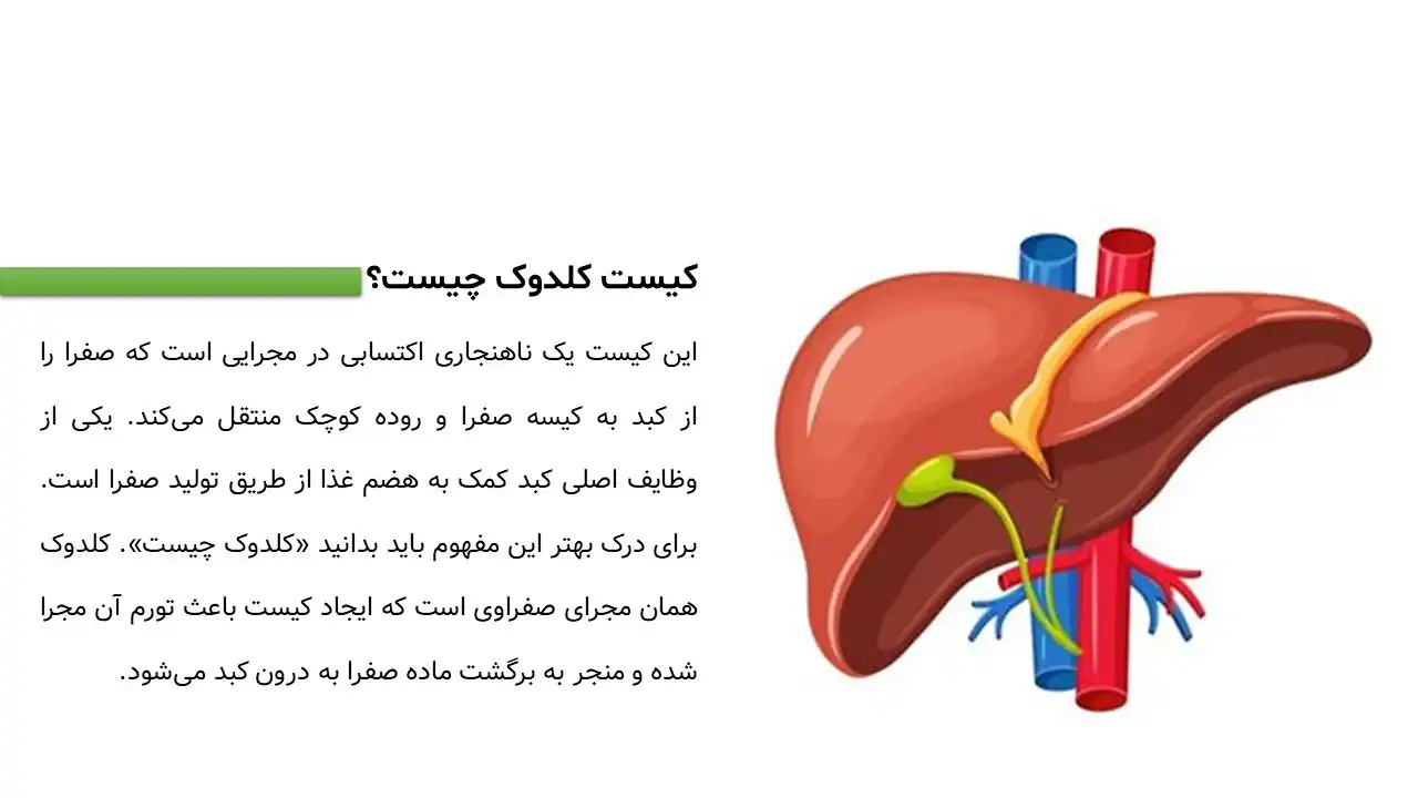 پاورپوینت کیست کلدوک
