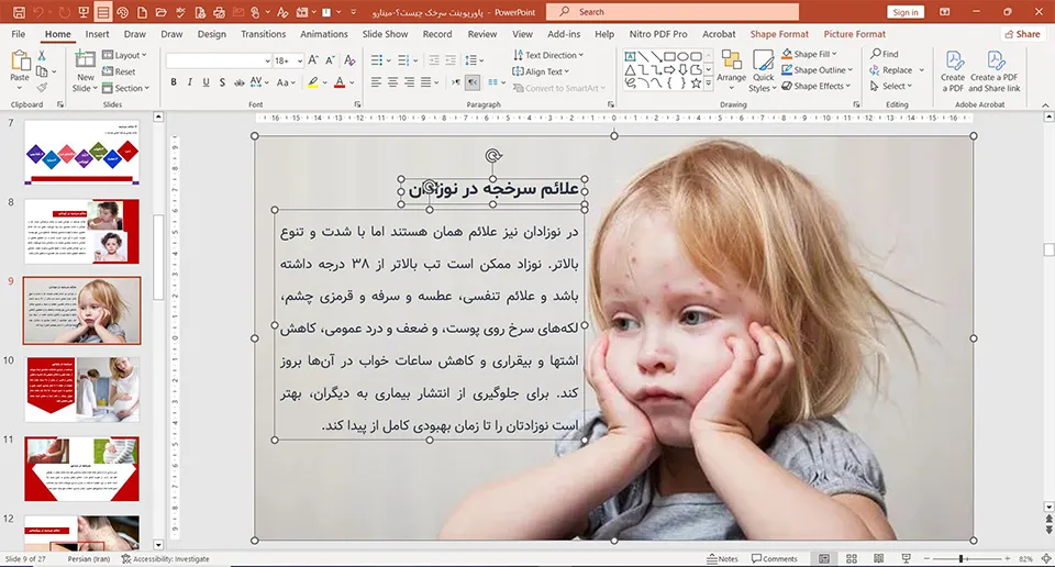 پاورپوینت سرخک