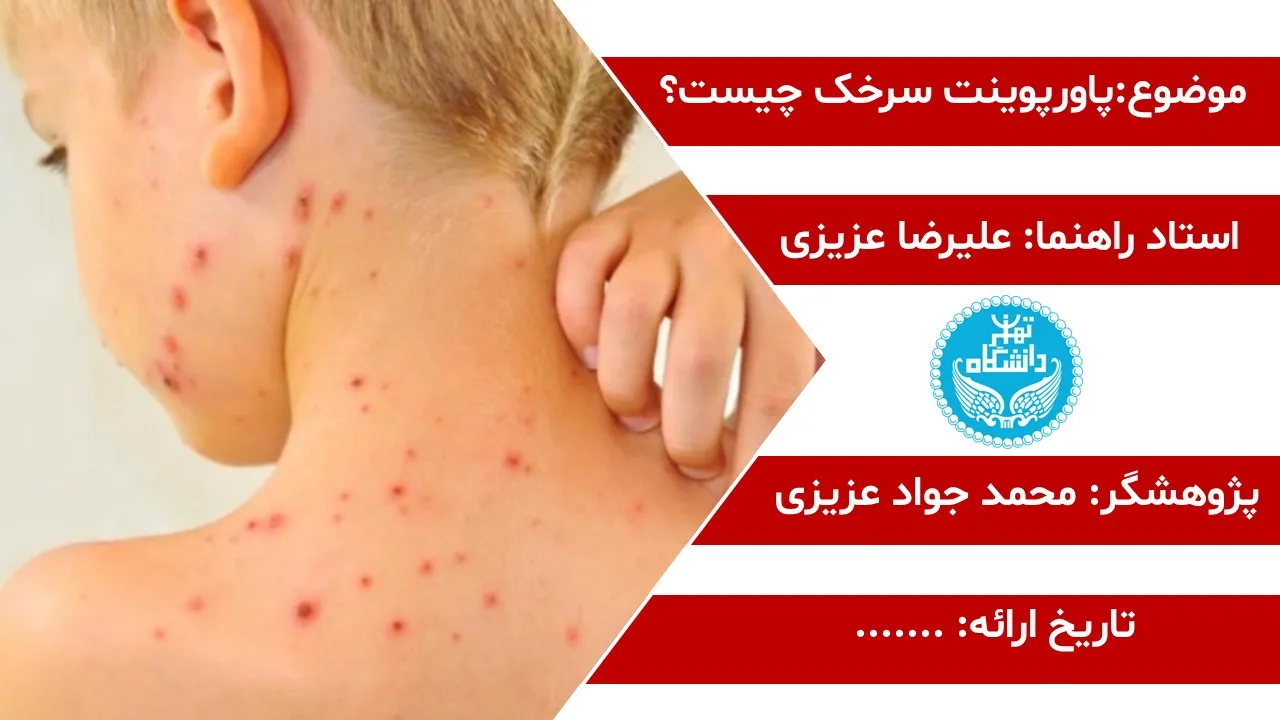 پاورپوینت سرخک