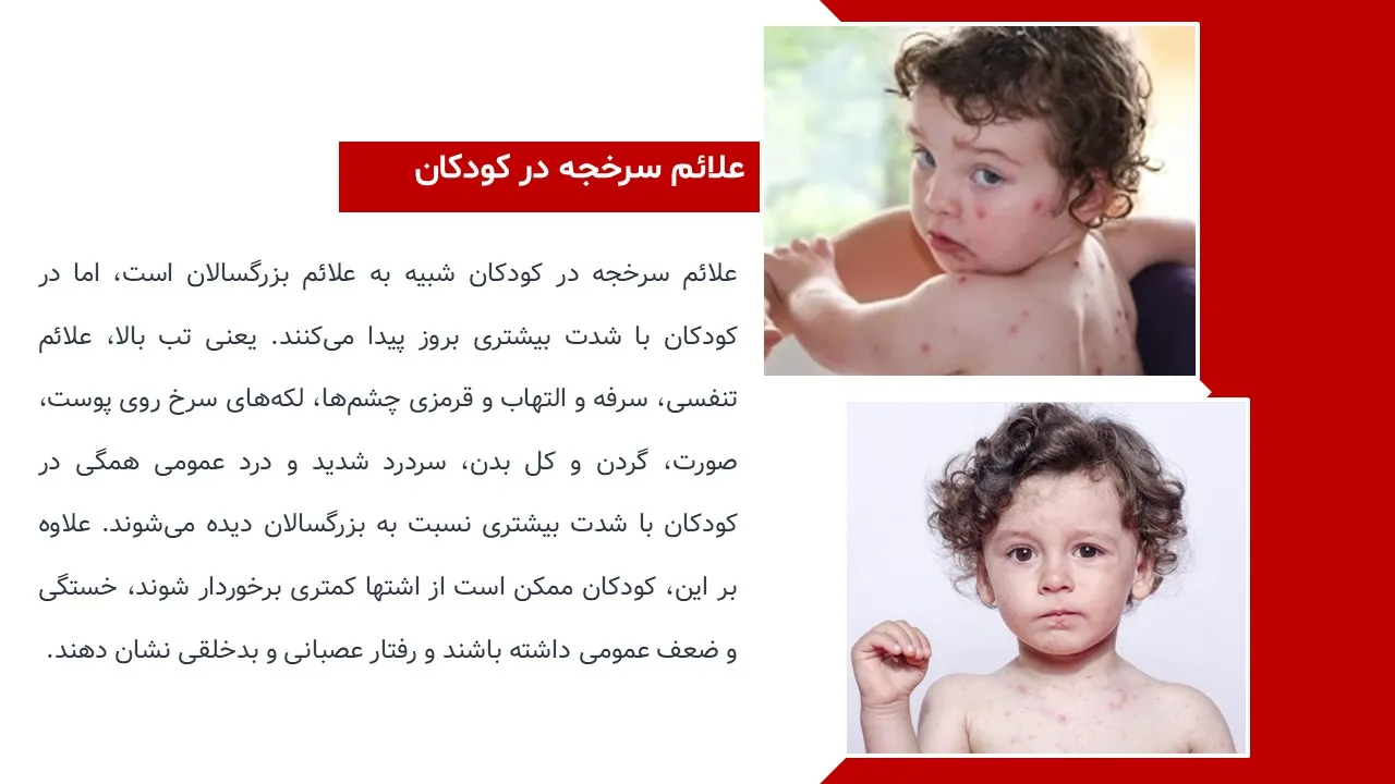 پاورپوینت سرخک
