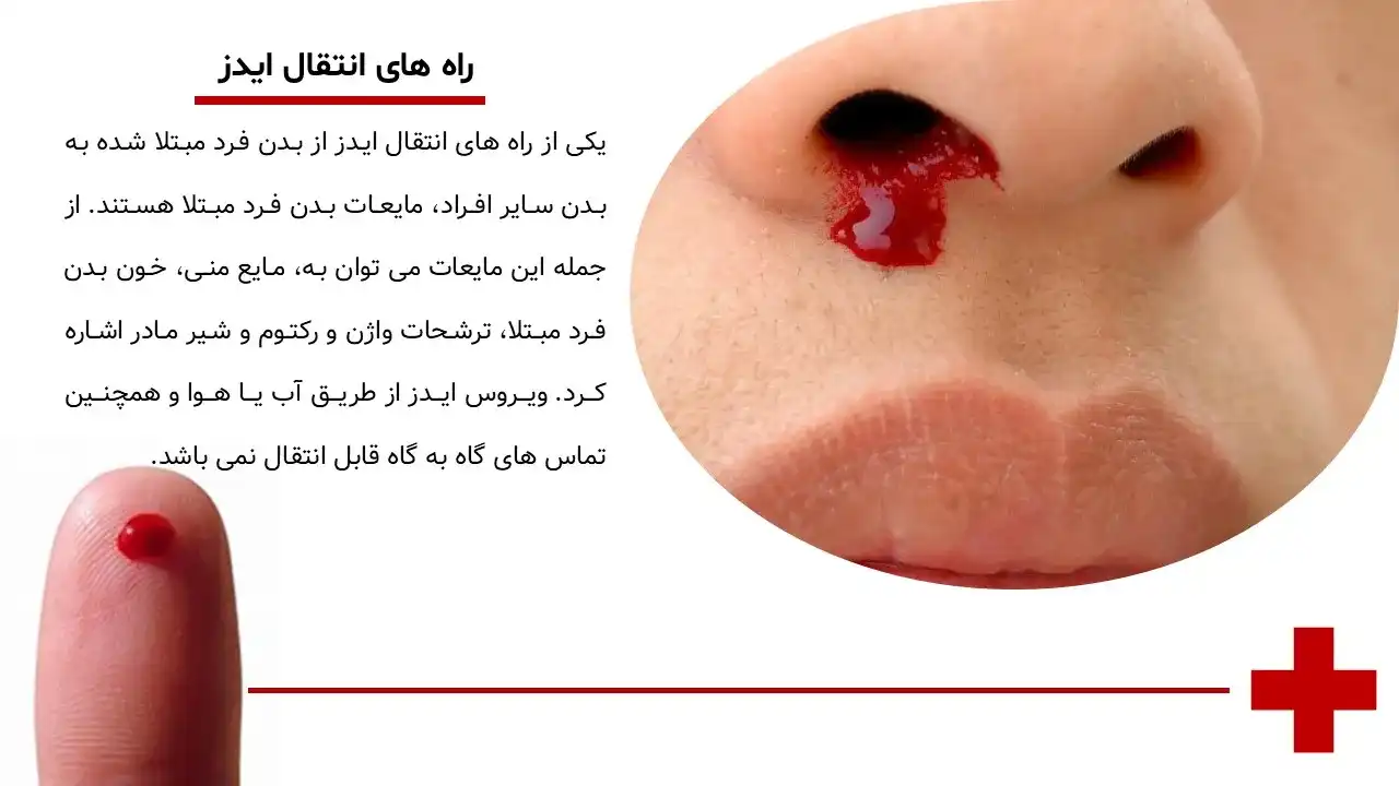 پاورپوینت ایدز