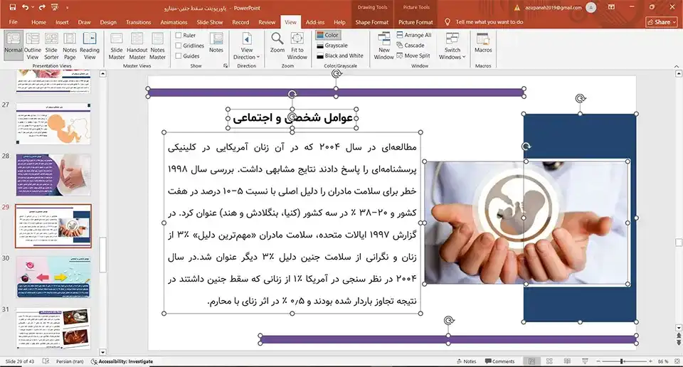 پاورپوینت سقط جنین