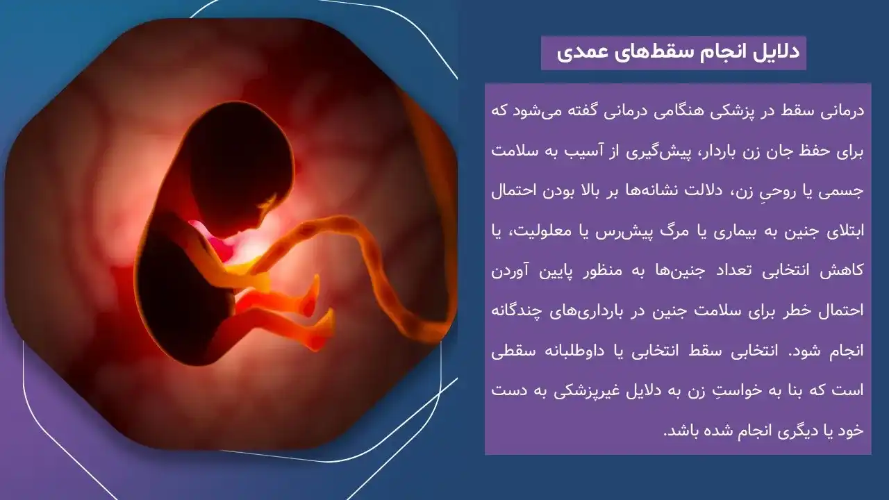 پاورپوینت سقط جنین