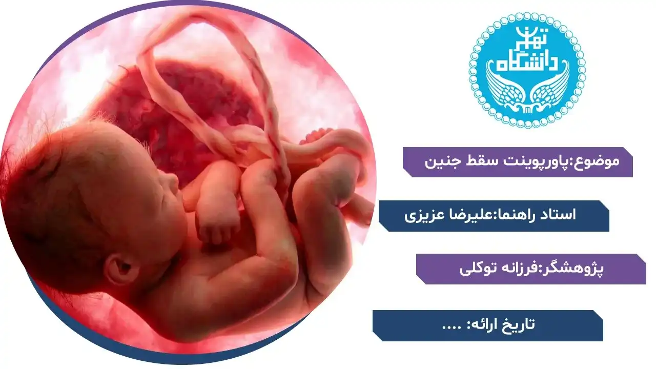 پاورپوینت سقط جنین
