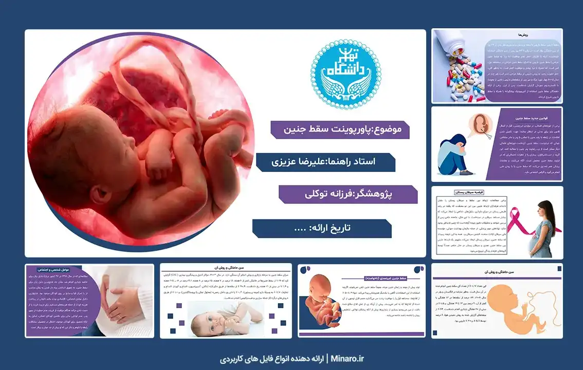 پاورپوینت سقط جنین