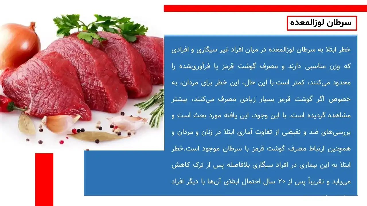 پاورپوینت سرطان پانکراس