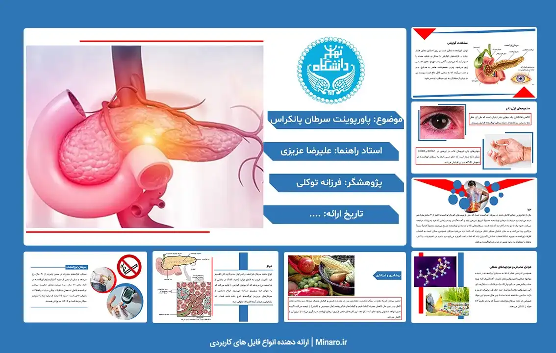 پاورپوینت سرطان پانکراس