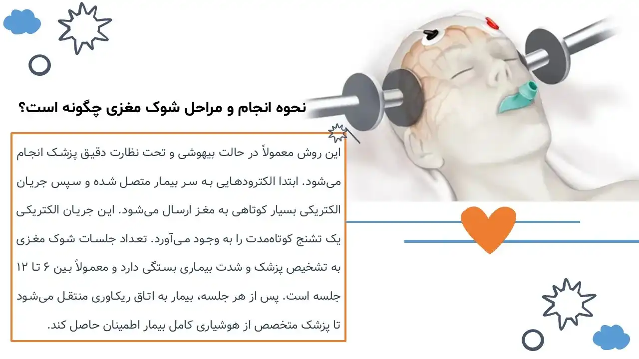 پاورپوینت شوک مغزی چیست؟