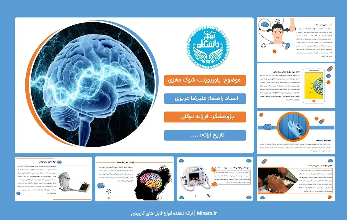 پاورپوینت شوک مغزی چیست؟