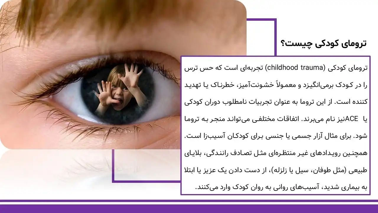 پاورپوینت ترومای کودکی