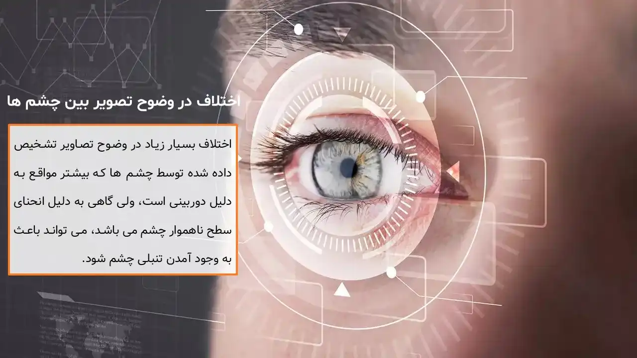 پاورپوینت تنبلی چشم
