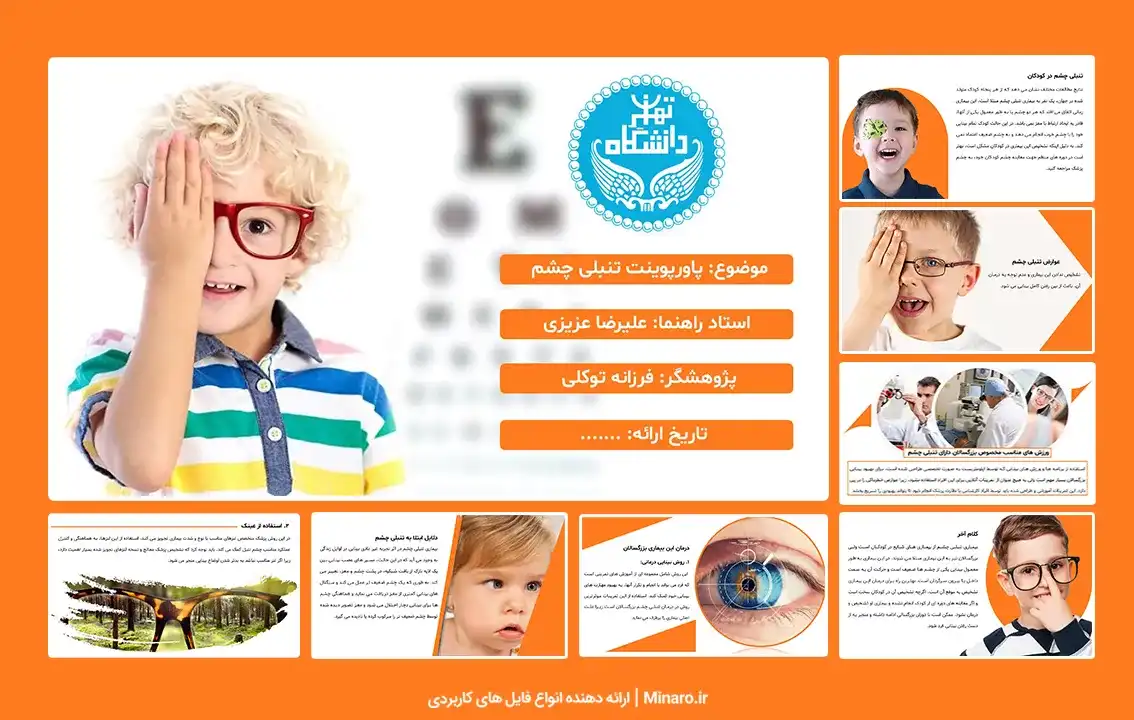 پاورپوینت تنبلی چشم