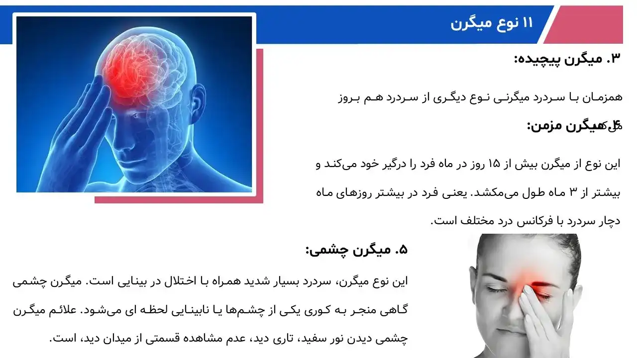 پاورپوینت میگرن