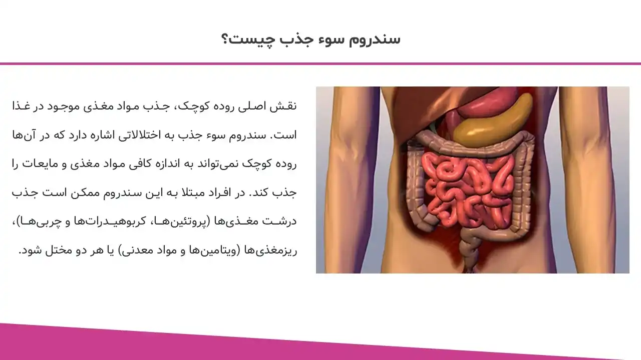 پاورپوینت سوء جذب چیست و عوارض آن
