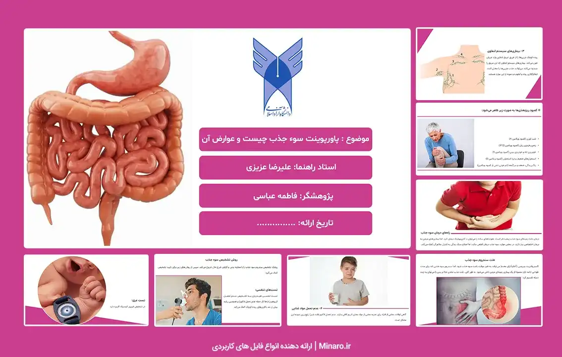 پاورپوینت سوء جذب چیست و عوارض آن
