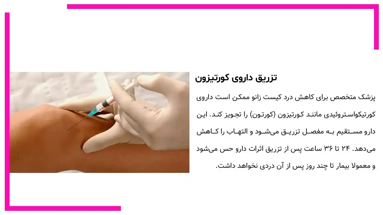 کیست بیکر زانو چیست؟