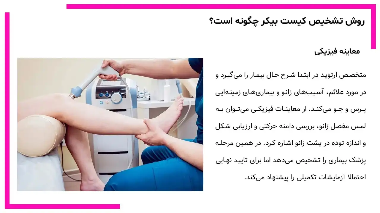 کیست بیکر زانو چیست؟