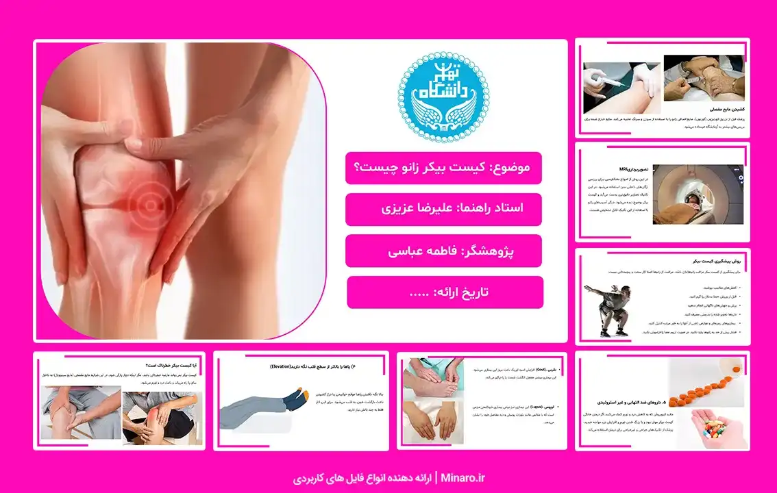 کیست بیکر زانو چیست؟