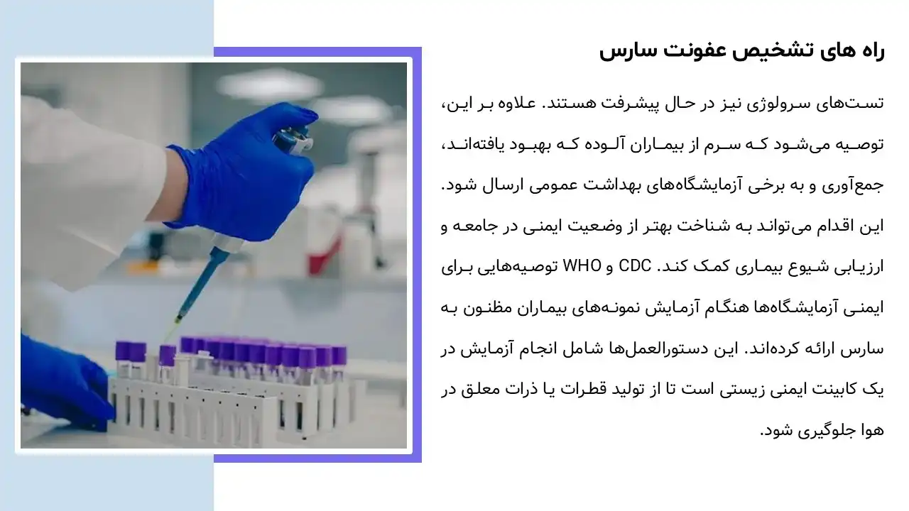 پاورپوینت بیماری سارس