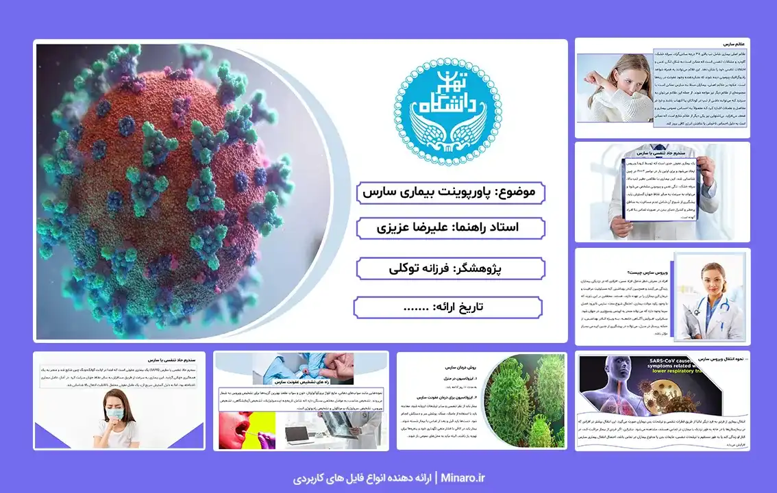 پاورپوینت بیماری سارس