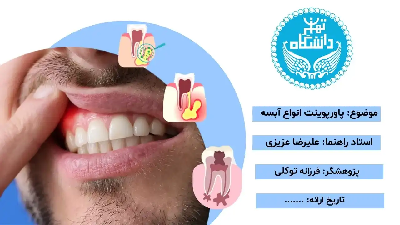 پاورپوینت آبسه دندان
