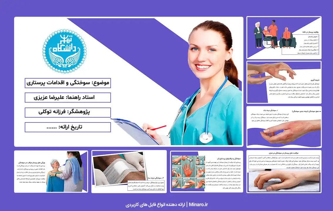 پاورپوینت سوختگی و اقدامات پرستاری