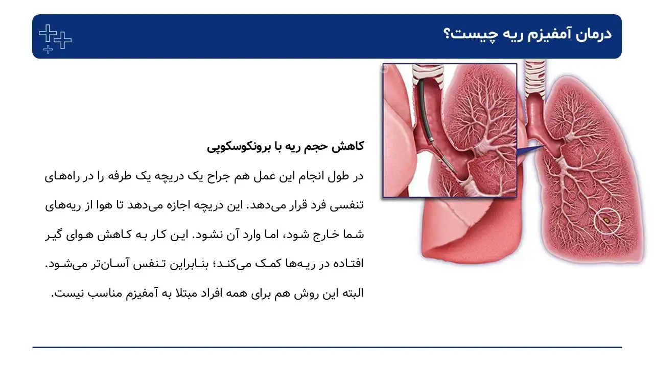 پاورپوینت بیماری آمفیزم