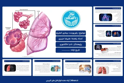 پاورپوینت بیماری آمفیزم