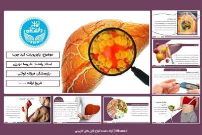 پاورپوینت کبد چرب و درمان آن