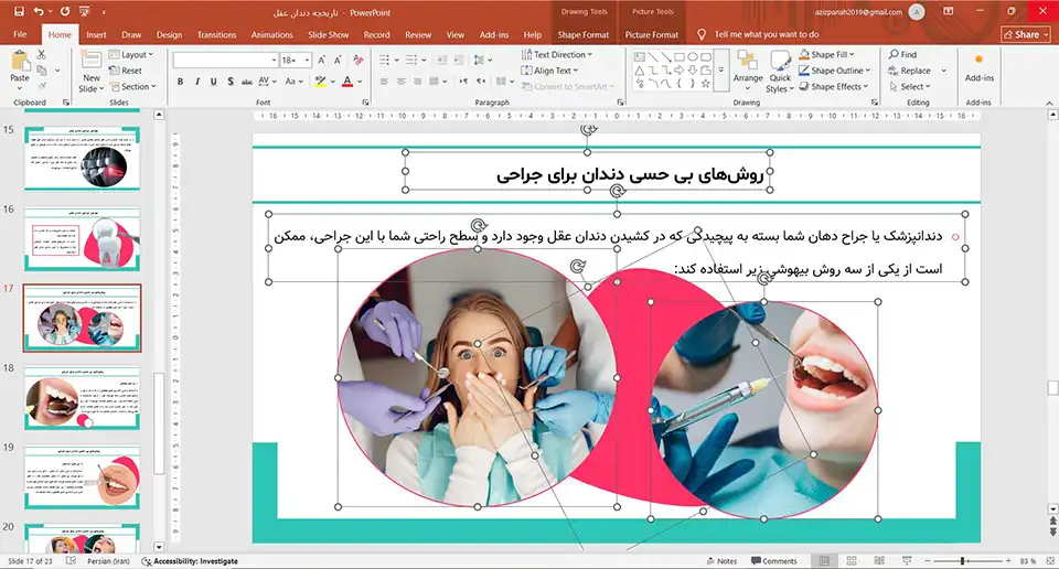 پاورپوینت تاریخچه دندان عقل