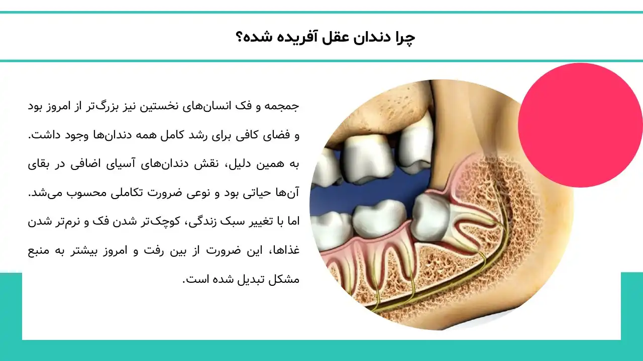 پاورپوینت تاریخچه دندان عقل