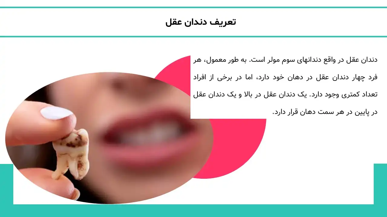 پاورپوینت تاریخچه دندان عقل