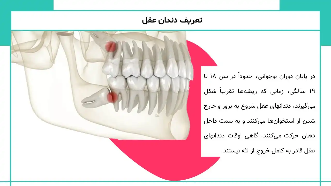 پاورپوینت تاریخچه دندان عقل