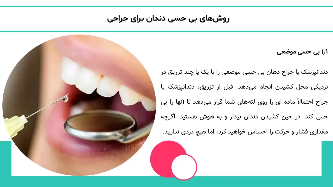 پاورپوینت تاریخچه دندان عقل