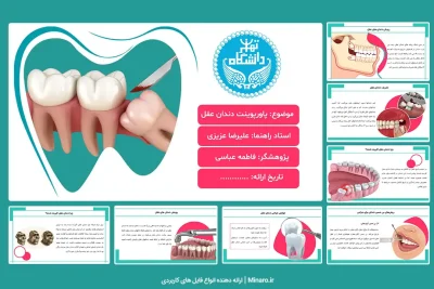 پاورپوینت تاریخچه دندان عقل