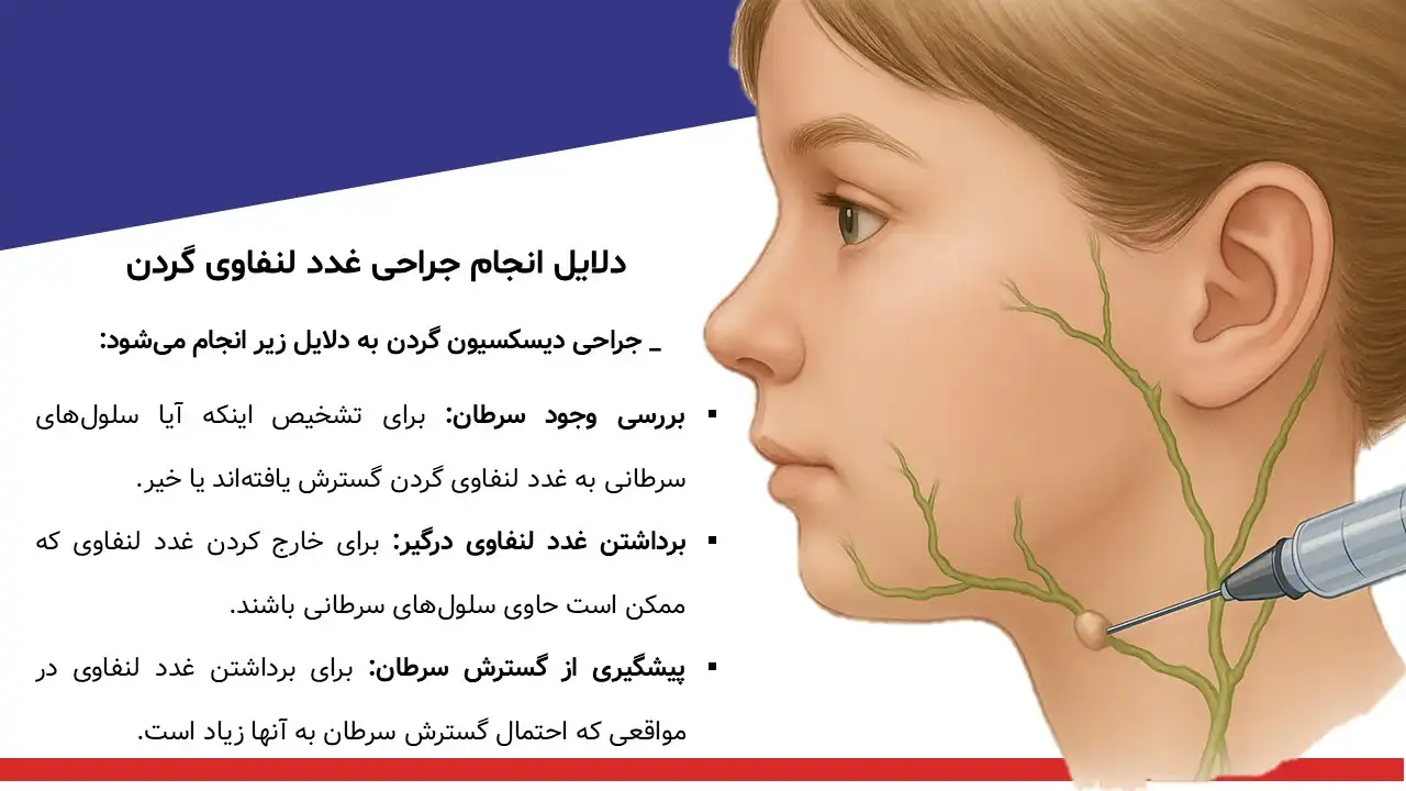 پاورپوینت جراحی غدد لنفاوی گردن
