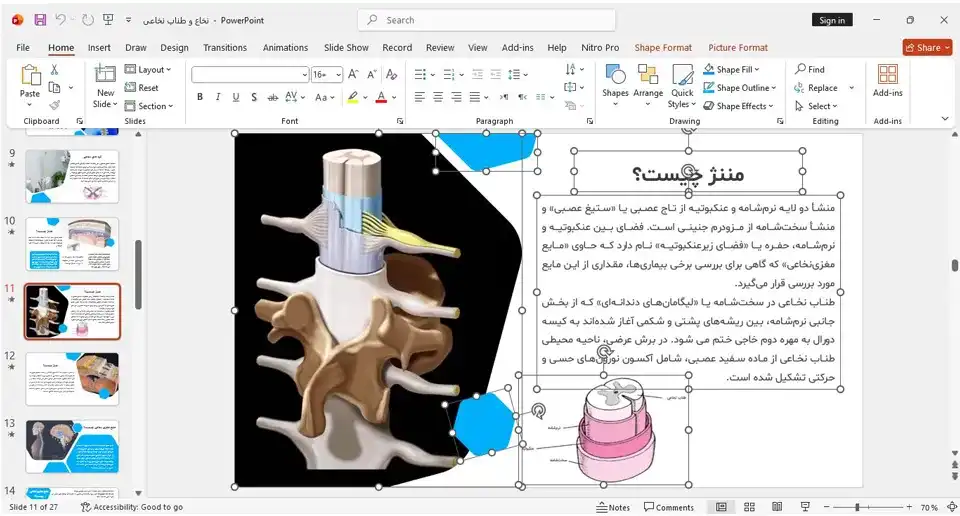 پاورپوینت نخاع و طناب نخاعی