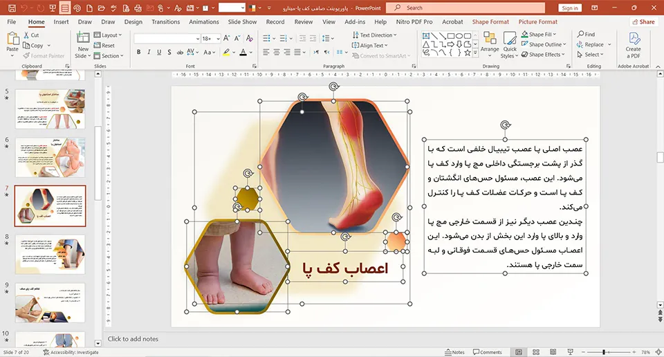 پاورپوینت صافی کف پا
