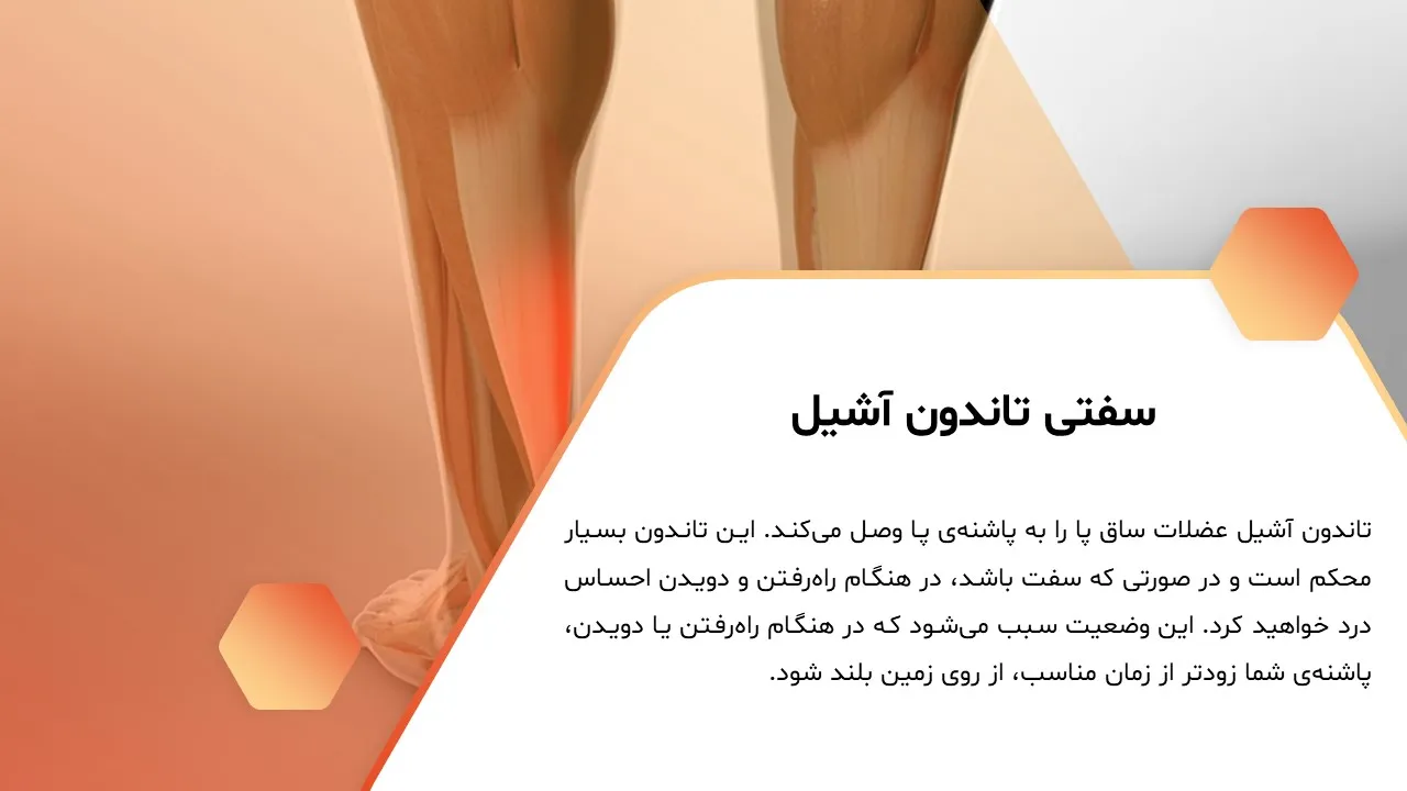 پاورپوینت صافی کف پا