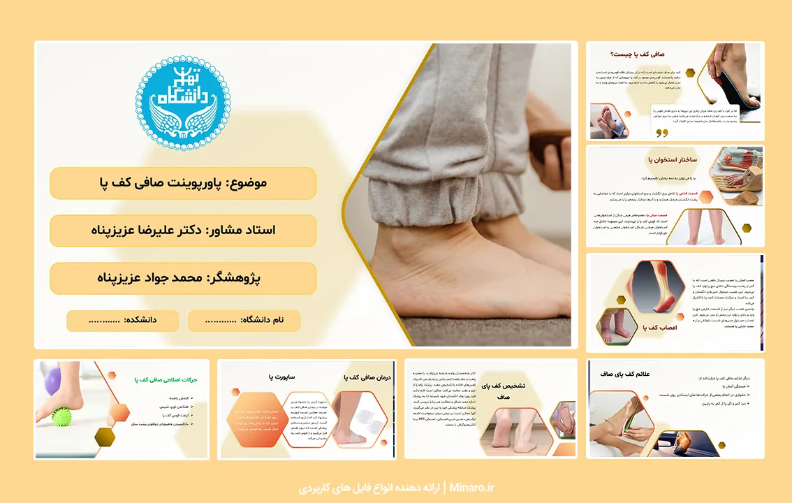 پاورپوینت صافی کف پا