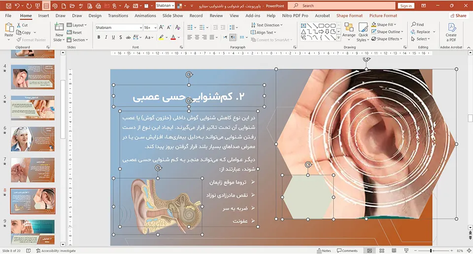hearing-loss-deafness-powerpoint-02 پاورپوینت کم شنوایی و ناشنوایی