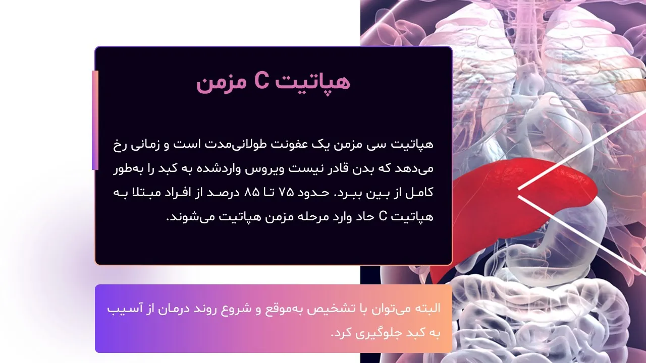 پاورپوینت هپاتیت سی