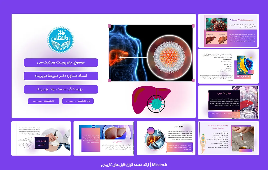 پاورپوینت هپاتیت سی