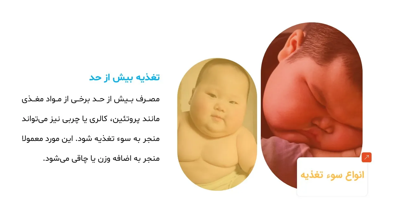 پاورپوینت سوء تغذیه