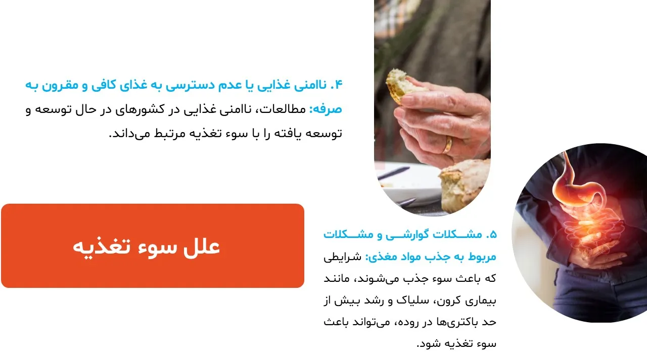 پاورپوینت سوء تغذیه