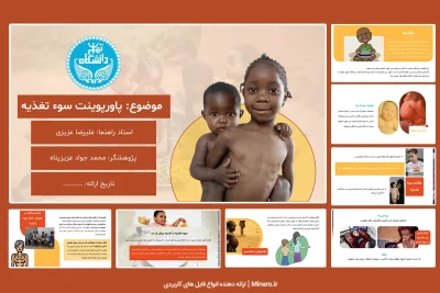 پاورپوینت سوء تغذیه