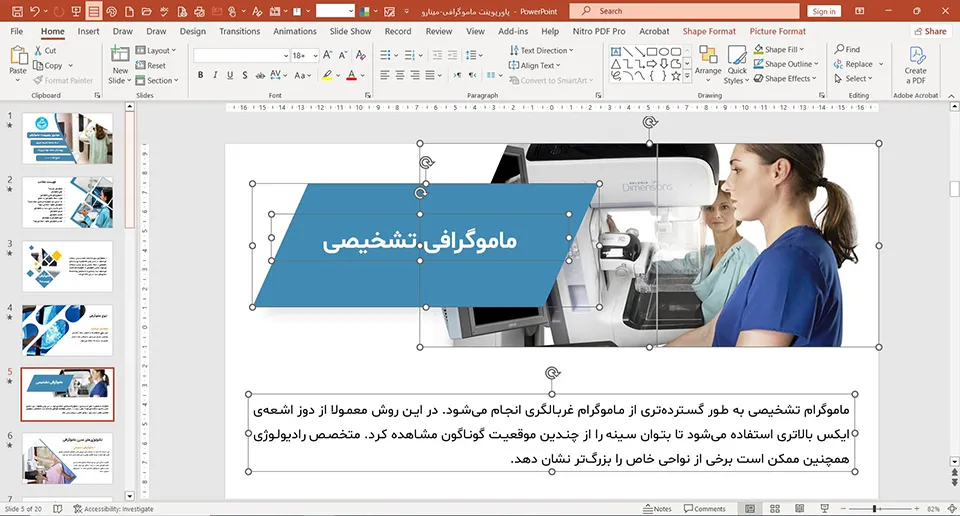 پاورپوینت ماموگرافی