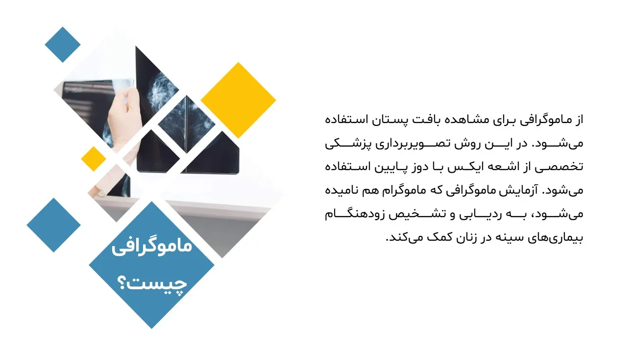 پاورپوینت ماموگرافی