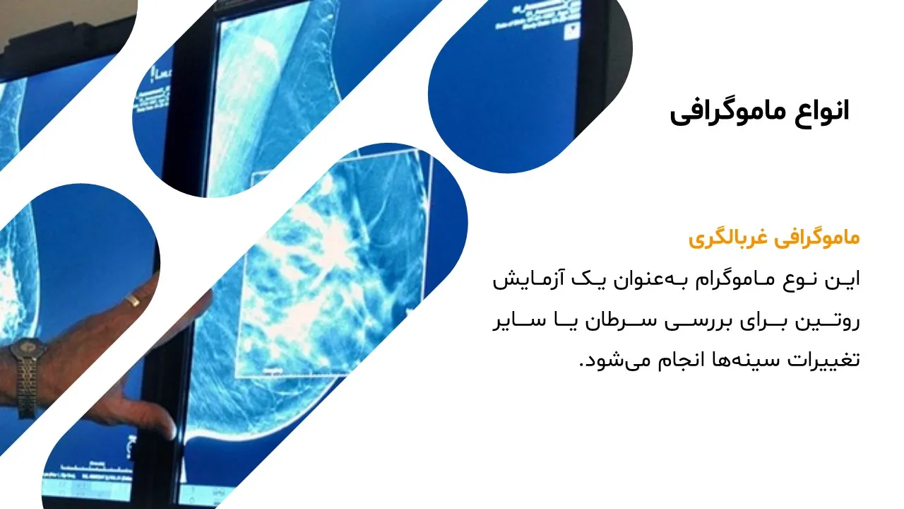 پاورپوینت ماموگرافی